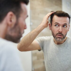 Microneedlings for androgenetic alopecia