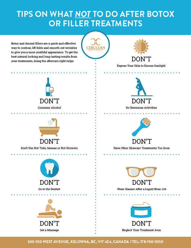 botox, filler, Kelowna, British Columbia, dermal fillers